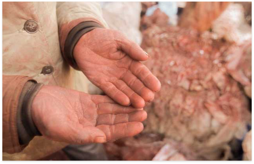 child's hands destroyed by hard work